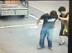 Xiaomi Mi 4C Meledak di Celana, Pengguna Luka Bakar Serius