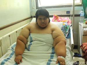 Yunita Maulidia, Remaja asal Sidoarjo Berbobot 125 Kg Dirawat di RSUD Sidoarjo