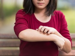 Remaja Ini Alergi Air Matanya Sendiri, Kok Bisa?