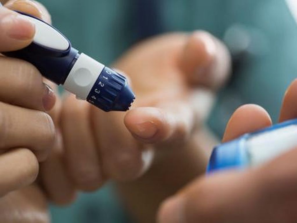 Mus Mulyadi Jatuh Bangun Lawan Diabetes, Kenali Faktor Risikonya