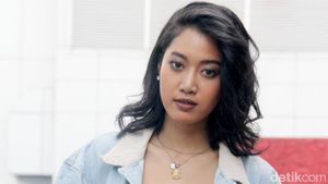 Tambah Mancung, Widi Vierratale Jadi Lebih Cantik?