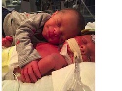 Menyentuh! Foto Bayi Kembar Memeluk Saudaranya yang Sakit