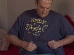 Berhasil Turunkan Bobot, Kini Pria Ini Berusaha Singkirkan Kulit Menggelambirnya