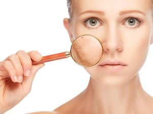 5 Makanan Paling Ampuh Atasi Masalah Kulit Kering 5 Makanan Paling Ampuh Atasi Masalah Kulit Kering