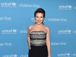 Alyssa Milano Mencintai Bekas Luka Caesar