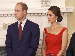 Seperti Pangeran William, Makin Banyak Millennial Mengalami Kebotakan Dini