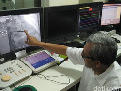 Operasi Pemasangan Alat Pacu Jantung Tanpa Kabel Pertama Dilakukan di Indonesia