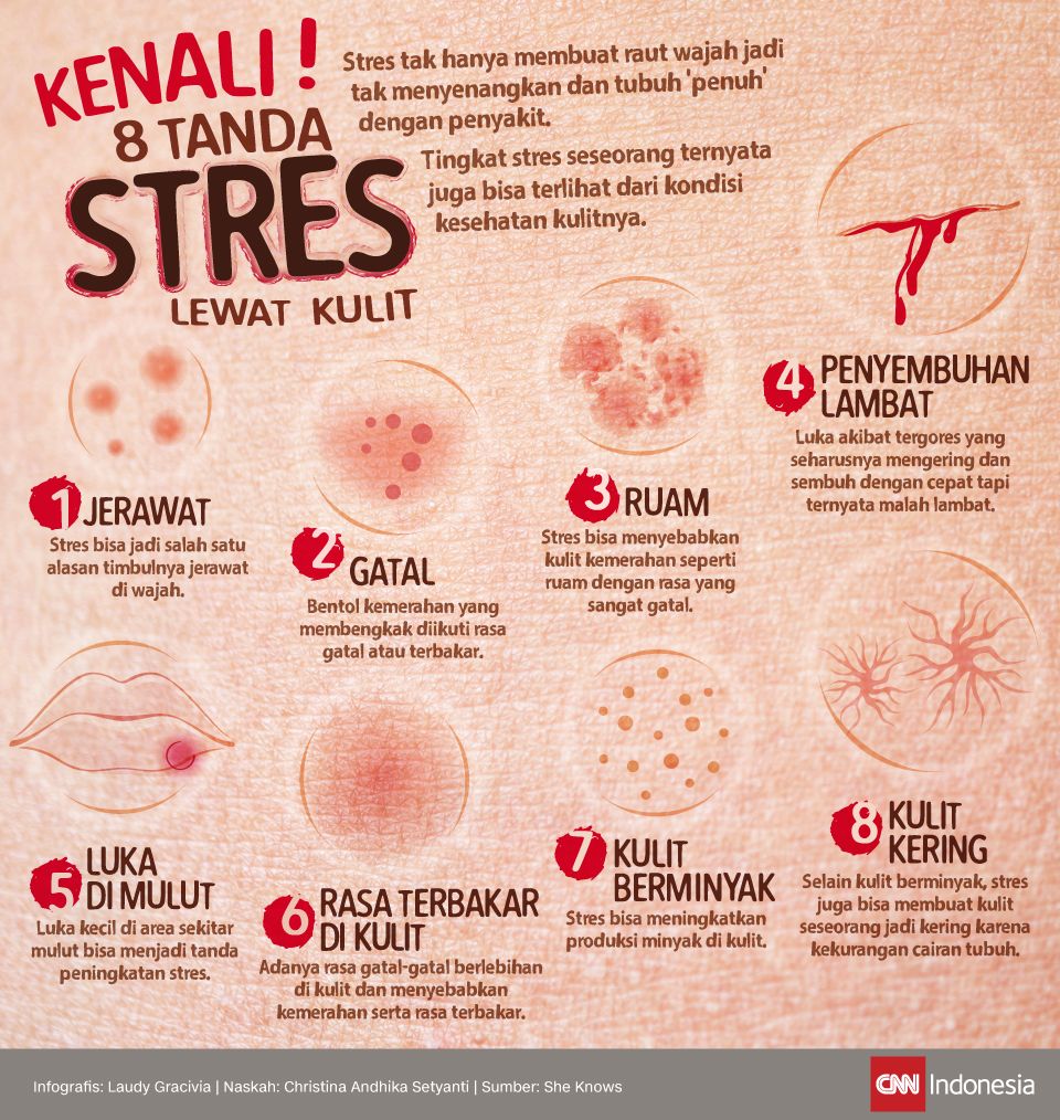 Infografis Kenali Stres Lewat kulit