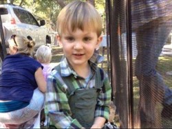 Digigit Ular Paling Berbisa di Australia, Balita ini Alami Kerusakan Otak