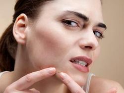 Pakai Aloe Vera Malah Bikin Berjerawat, Mengapa?