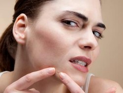 5 Jenis Kosmetik yang Perlu Dihindari untuk Wajah Berjerawat