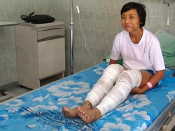 Pelari Lomba Lintas Gunung di Jawa Disiram Air Keras di Boyolali