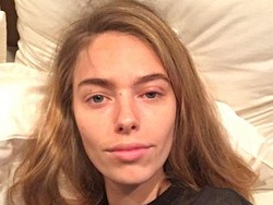 Curhat Model yang Hampir Buta Karena Infeksi Brush Makeup