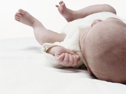 Kurang Asupan Vitamin K Bisa Picu Stroke pada Bayi