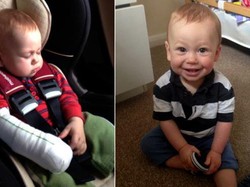 Kena Catok Rambut Panas, Lengan Bayi Laki-laki ini Terbakar