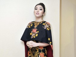 Isyana Sarasvati Jalani Operasi Hilangkan Minus Mata