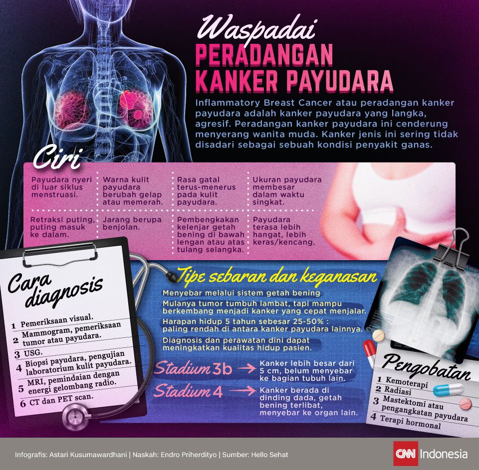 Infografis Waspadai Peradangan Kanker Payudara