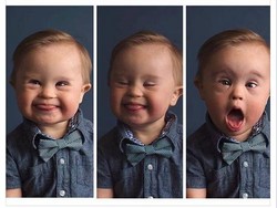 Foto Bayi dengan Down Syndrome yang Ditolak Agensi Iklan Ini Jadi Viral