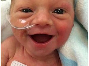 Viral, Foto Bayi Prematur Usia 5 Hari yang Sedang Tersenyum