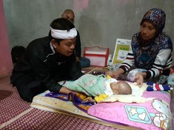 Bayi Rizki di Cianjur Menderita Penyakit Langka