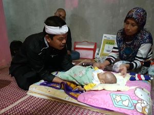 Bayi Rizki di Cianjur Menderita Penyakit Langka Bayi Rizki di Cianjur Menderita Penyakit Langka