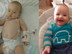 Bayi Ini Diserang Tiga Virus Sekaligus, Diduga karena Duduk di Troli