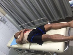 5 Napi Rutan Batam Berusaha Kabur dengan Lompati Tembok