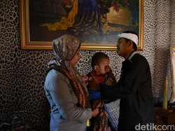 Anak Derita Penyakit Kelainan, Ibu ini Sambangi Rumah Bupati Dedi
