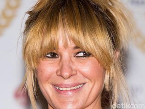 Kecanduan Minum Soda, 5 Gigi Aktris Inggris Ini Busuk