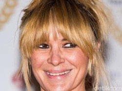 Kecanduan Minum Soda, 5 Gigi Aktris Inggris Ini Busuk