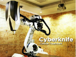 Pertama di Dunia, Penyembuhan Kanker secara Real Time, Tanpa Sakit & Operasi