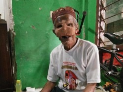 Menemui Kakek Abdurahman, Penjual Koran yang Kena Kanker Wajah di Kokas