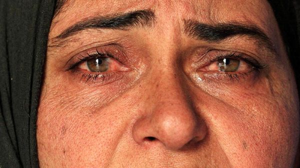 Potret Kesedihan Pengungsi di Mosul