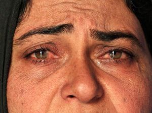 Potret Kesedihan Pengungsi di Mosul