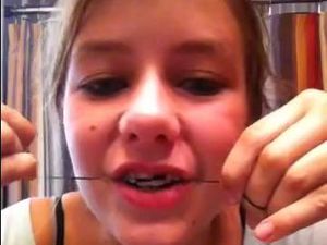 Ngeri, Tren Membuat Kawat Gigi Sendiri di Kalangan Remaja