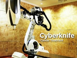 Pertama di Dunia, Penyembuhan Kanker secara Real Time, Tanpa Sakit dan Operasi