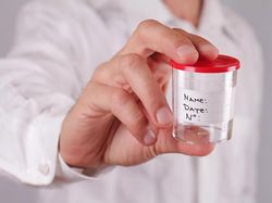 Umur 35 Tahun Belum Menikah, Perlukah Menabung Sperma?