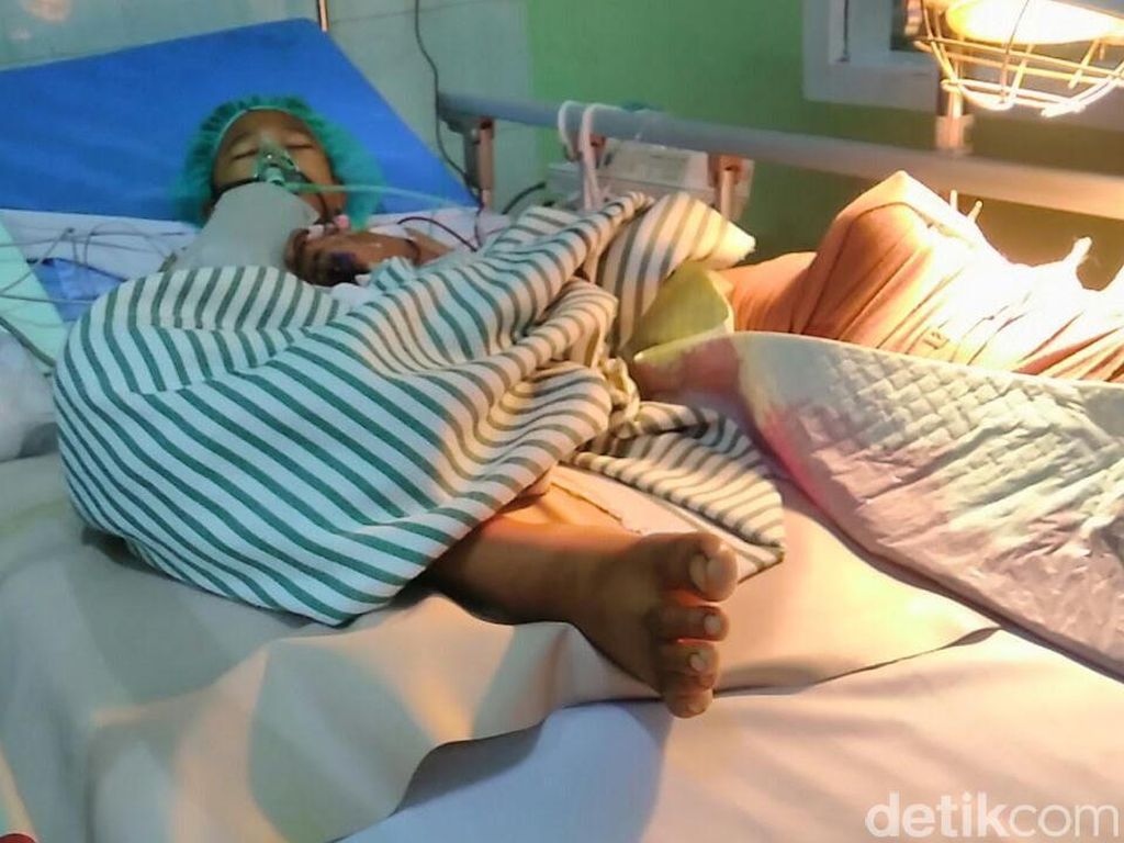 Diduga Jadi Korban Malpraktik, Kaki Setyo Jadi Membusuk Diduga Jadi Korban Malpraktik, Kaki Setyo Jadi Membusuk