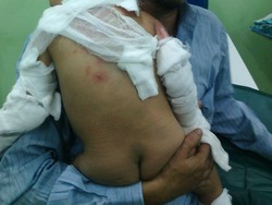 Identitas 4 Balita Korban Luka Bom di Depan Gereja Oikumene Samarinda