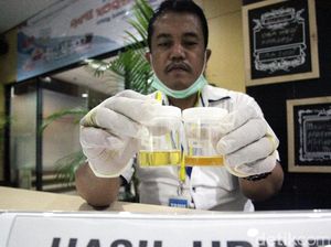 Urine Tercium Tak Seperti Biasanya? Waspada, Mungkin Ini 8 Penyebabnya (2)