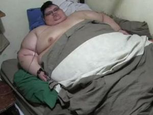 Terberat di Dunia, Pria Ini Obesitas Sampai 595 Kg