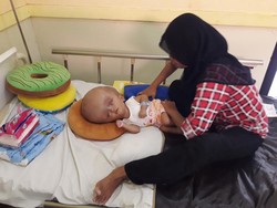 Menengok Gubuk Reyot yang Ditinggali Balita Penderita Hidrosefalus di Tuban