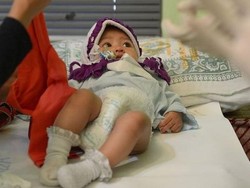 Mengapa Praktik Sunat Perempuan Masih Berlangsung di Singapura?