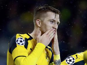 Tuchel Akui Cederanya Reus Jadi Kehilangan Besar untuk Dortmund Tuchel Akui Cederanya Reus Jadi Kehilangan Besar untuk Dortmund