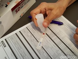 Jumlah Penderita HIV/AIDS di Brebes Tiap Tahun Meningkat