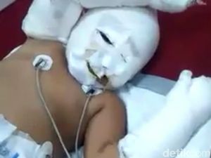 Kabar Terbaru Trinity-Alvaro, Balita Korban Bom Jaringan ISIS di Indonesia Kabar Terbaru Trinity-Alvaro, Balita Korban Bom Jaringan ISIS di Indonesia