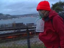 Meski Paru-parunya Terluka, Pria ini Sanggup Selesaikan Maraton