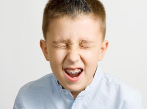 Seberapa Perlu Anak Pakai Kawat Gigi Agar Giginya Tumbuh Rapi?