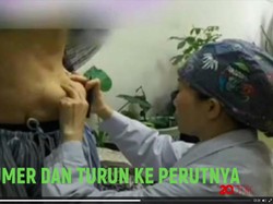 Tragis! Pakai Injeksi Ilegal, Payudara Malah Pindah ke Perut