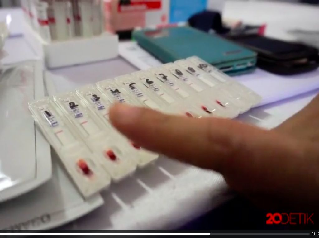 5 Provinsi dengan Kasus HIV Paling Tinggi, DKI Salah Satunya 5 Provinsi dengan Kasus HIV Paling Tinggi, DKI Salah Satunya